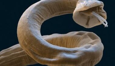 Ascaris parasite in human body