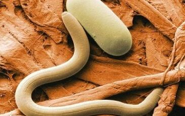 Types of contact parasites in the human body