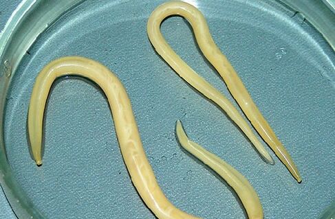 Roundworms from a child's body
