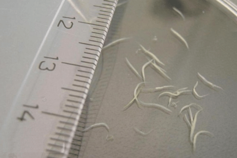 how to remove pinworms from a child