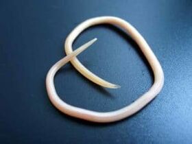 Human roundworm extracted from the body