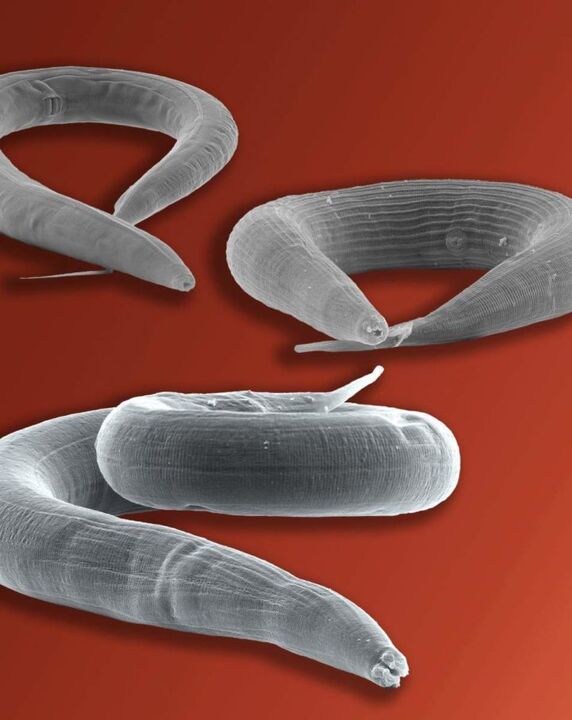 Pinworm parasite living in the intestine