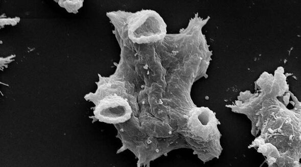 Negleria fowlera is a unicellular parasite dangerous to human life. 