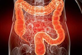 human gut infested with parasites