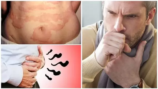Allergies, coughing and gas are signs of damage to the body by worms