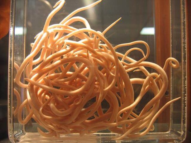 Roundworms are worms that belong to the nematode class. 