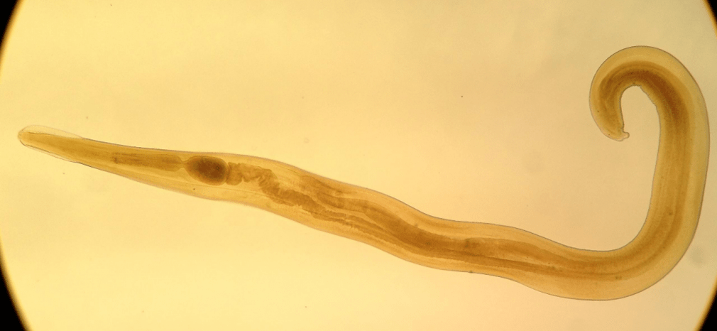 Pinworms are a common parasite in children. 