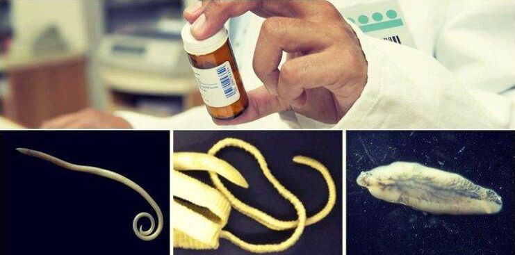 Types of worms and a medical method to get rid of them